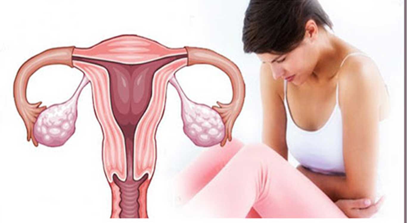 Abnormal-uterin- bleeding-AUB-heavy-periods